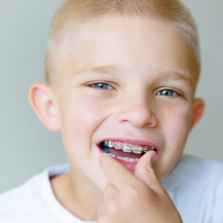 Ortodonzia Intercettiva nei bambini e negli adolescenti - Giorgio Gurrera