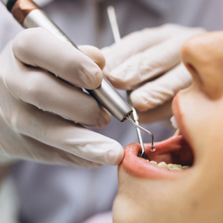 Ortodonzia pre – protesica - Giorgio Gurrera